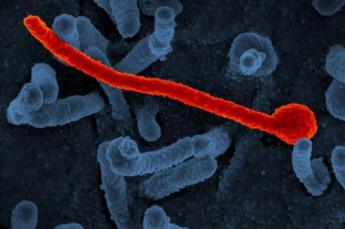 São Paulo investiga caso suspeito do vírus Ebola em paciente de 37 anos